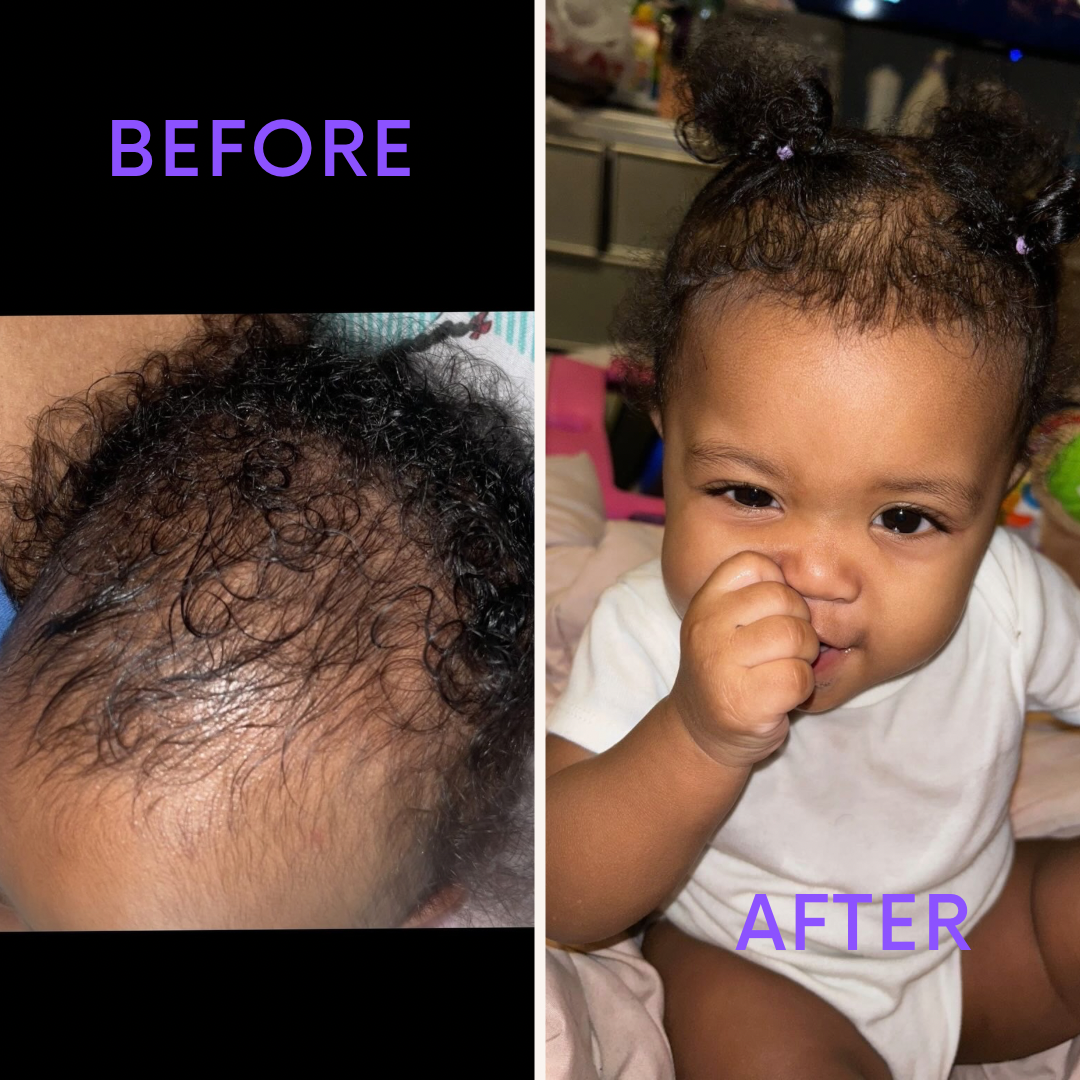 Hair Growth Oil (1 oz) (Extra Potent)