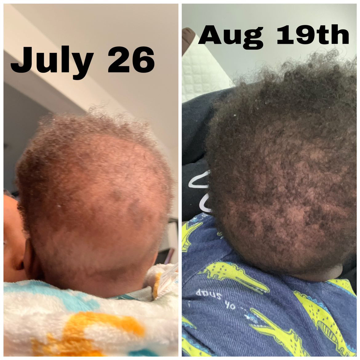 Baby’s/Children Gentle Formula