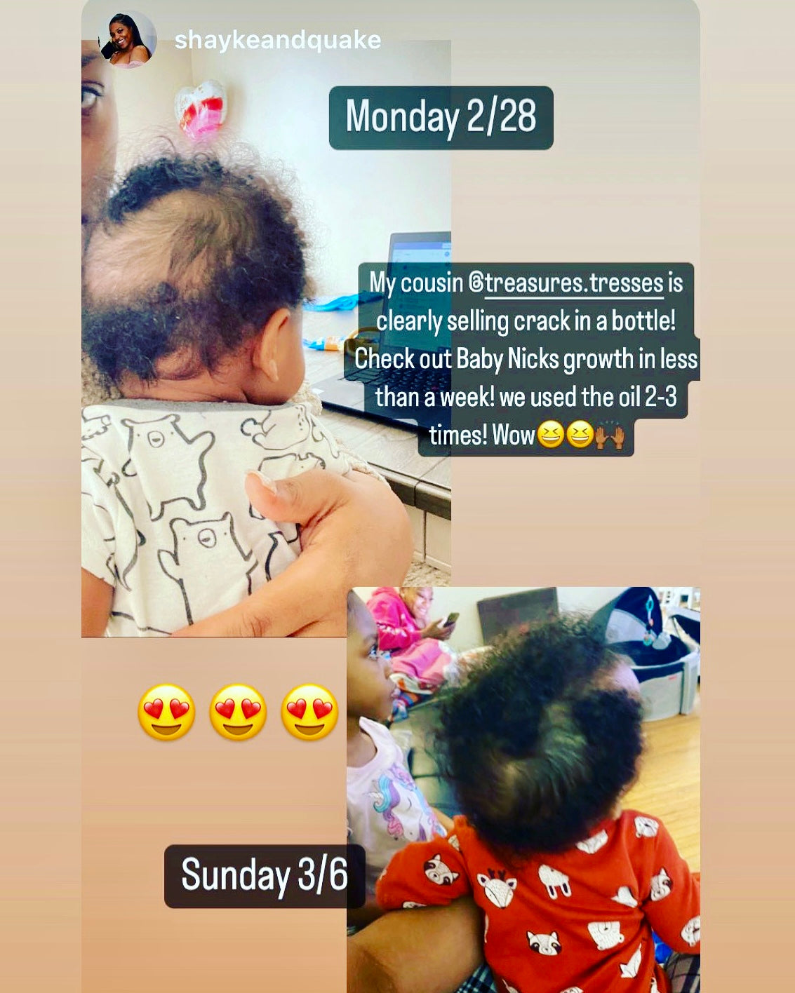 Baby’s/Children Gentle Formula